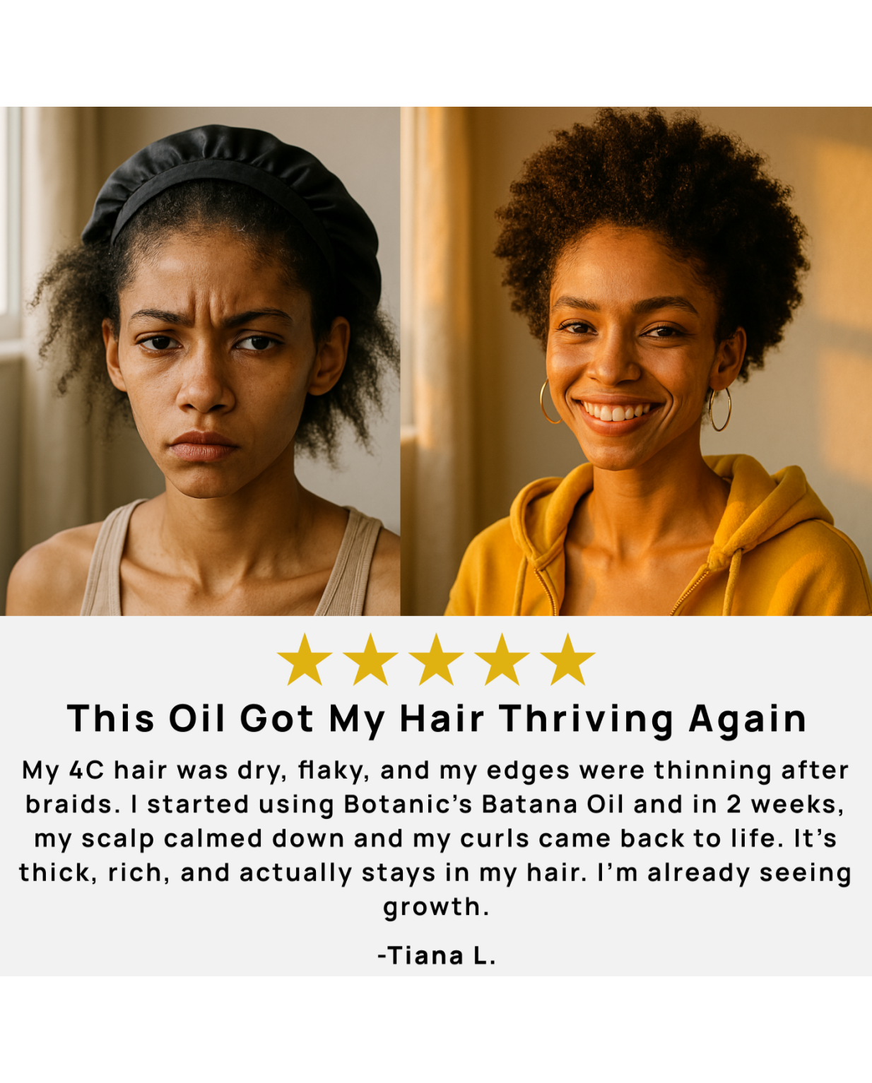 Batana Oil for Hair Growth, Botana Oil Hair Growth, 100% Honduras from Honduras, Raw Batana Paste Hair Mask, Prevents Hair Loss, Enhances Thickness for All Hair (1pcs)